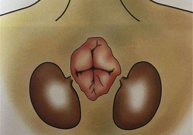 貓咪肛門腺怎么擠_貓咪擠肛門腺視頻教程_擠貓咪的肛門腺